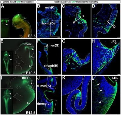 Temporal Expression of Wnt1 Defines the Competency State and Terminal Identity of Progenitors in the Developing Cochlear Nucleus and Inferior Colliculus